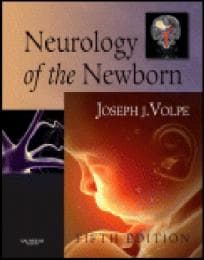 Cover von Neurology of the Newborn
