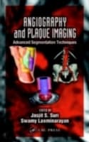 Cover von Angiography and Plaque Imaging