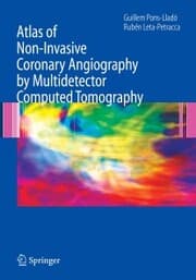 Cover von Atlas of Non-Invasive Coronary Angiography by Multidetector Computed Tomography