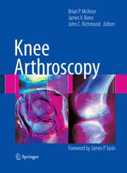 Cover von Knee Arthroscopy