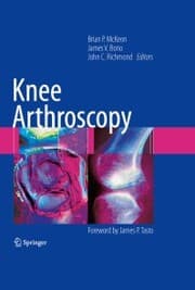 Cover von Knee Arthroscopy