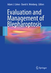 Cover von Blepharoptosis
