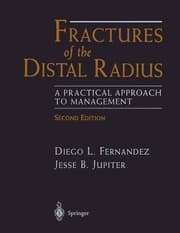 Cover von Fractures of the Distal Radius