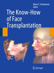 Cover von The Know-How of Face Transplantation