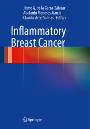 Cover von Inflammatory Breast Cancer