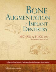 Cover von Bone Augmentation in Implant Dentistry