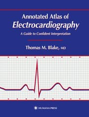 Cover von Annotated Atlas of Electrocardiography