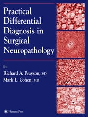 Cover von Practical Differential Diagnosis in Surgical Neuropathology