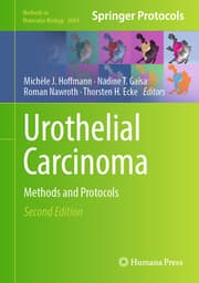 Cover von Urothelial Carcinoma