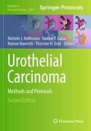 Cover von Urothelial Carcinoma