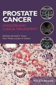 Cover von Prostate Cancer