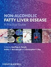 Cover von Non-Alcoholic Fatty Liver Disease