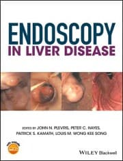 Cover von Endoscopy in Liver Disease