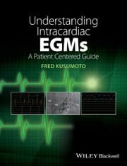 Cover von Understanding Intracardiac EGMs