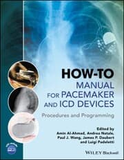 Cover von How-to Manual for Pacemaker and ICD Devices