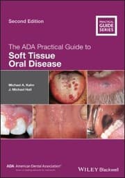 Cover von The ADA Practical Guide to Soft Tissue Oral Disease