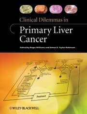 Cover von Clinical Dilemmas in Primary Liver Cancer