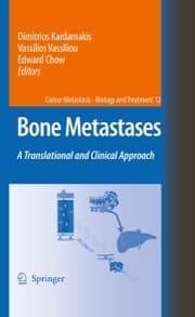 Cover von Bone Metastases