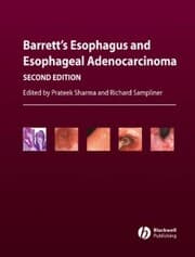 Cover von Barrett's Esophagus and Esophageal Adenocarcinoma