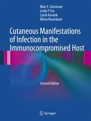 Cover von Cutaneous Manifestations of Infection in the Immunocompromised Host