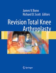 Cover von Revision Total Knee Arthroplasty