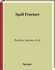 Cover von Spall Fracture