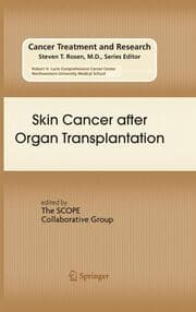 Cover von Skin Cancer after Organ Transplantation
