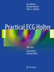 Cover von Practical ECG Holter