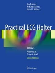Cover von Practical ECG Holter