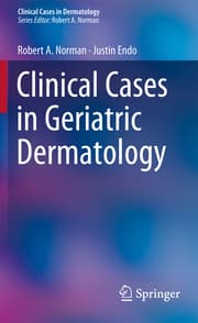 Cover von Geriatric Dermatology