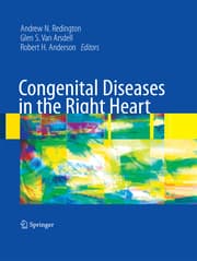 Cover von Congenital Diseases in the Right Heart