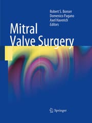 Cover von Mitral Valve Surgery