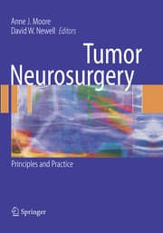 Cover von Tumor Neurosurgery