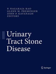 Cover von Urinary Tract Stone Disease