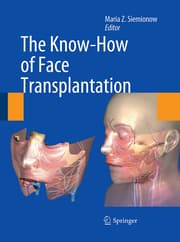 Cover von The Know-How of Face Transplantation