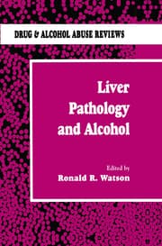 Cover von Liver Pathology and Alcohol
