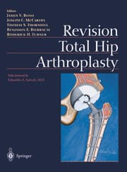 Cover von Revision Total Hip Arthroplasty