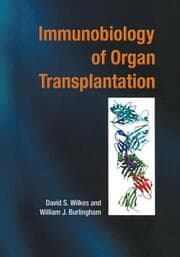 Cover von Immunobiology of Organ Transplantation