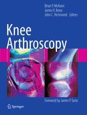 Cover von Knee Arthroscopy