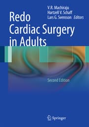 Cover von Redo Cardiac Surgery in Adults