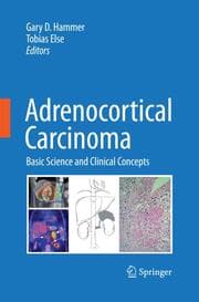 Cover von Adrenocortical Carcinoma