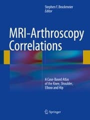 Cover von MRI-Arthroscopy Correlations