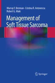 Cover von Management of Soft Tissue Sarcoma