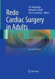 Cover von Redo Cardiac Surgery in Adults