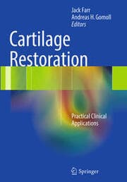 Cover von Cartilage Restoration