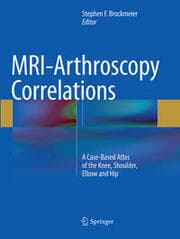 Cover von MRI-Arthroscopy Correlations