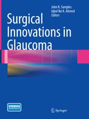 Cover von Surgical Innovations in Glaucoma