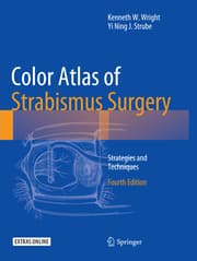 Cover von Color Atlas Of Strabismus Surgery