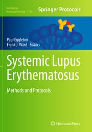 Cover von Systemic Lupus Erythematosus