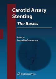 Cover von Carotid Artery Stenting: The Basics
